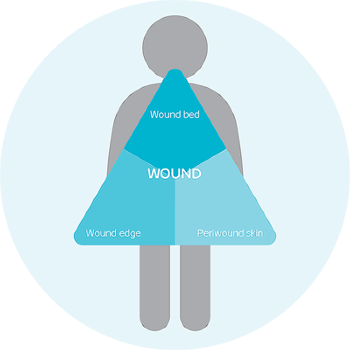 Triangle of Wound Assessment